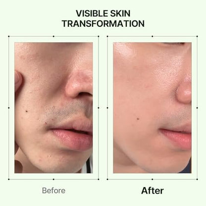 Orien Mugwort Collagen Pore Serum - 1.01 fl oz | Firming & Pore Minimizing Face Serum Avelisse