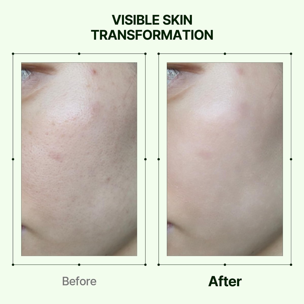 Orien Propolis Niacinamide Glow Serum – 1.01 fl.oz. Daily Brightening & Soothing Face Serum - görsel 11