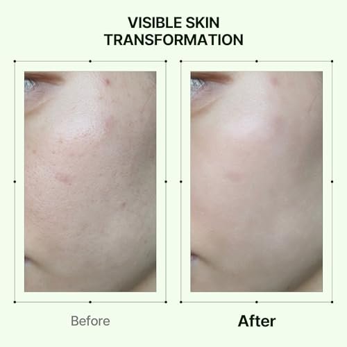 Orien Propolis Niacinamide Glow Serum – 1.01 fl.oz. Daily Brightening & Soothing Face Serum - görsel 12