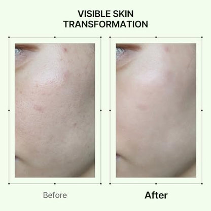 Orien Propolis Niacinamide Glow Serum – 1.01 fl.oz. Daily Brightening & Soothing Face Serum