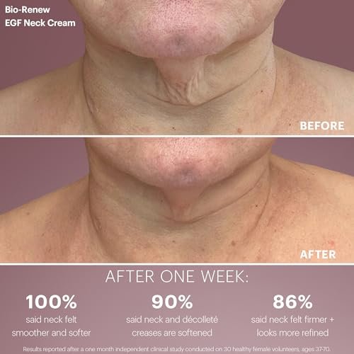 Glo Skin Beauty Bio-Renew EGF Neck Cream – Firming & Anti-Aging Treatment for Neck and Décolleté - görsel 6