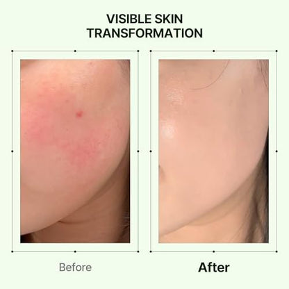 Orien Mugwort Zero Film Moisturizer 60ml – Niacinamide 2% + Panthenol + Glycerin + Adenosine Face Moisturizer Avelisse