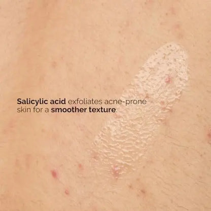 The Ordinary Salicylic Acid 0.5% Body Serum - Exfoliating Treatment for Acne-Prone Skin, 8.1 Fl Oz Avelisse