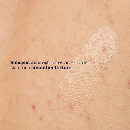 The Ordinary Salicylic Acid 0.5% Body Serum - Exfoliating Treatment for Acne-Prone Skin, 8.1 Fl Oz Avelisse