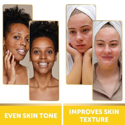 VALITIC Turmeric Kojic Acid Cleansing Pads - Exfoliating Dark Spot Remover for Face with Vitamin C, Alpha Arbutin, Niacinamide and Retinol - 60 Count Avelisse