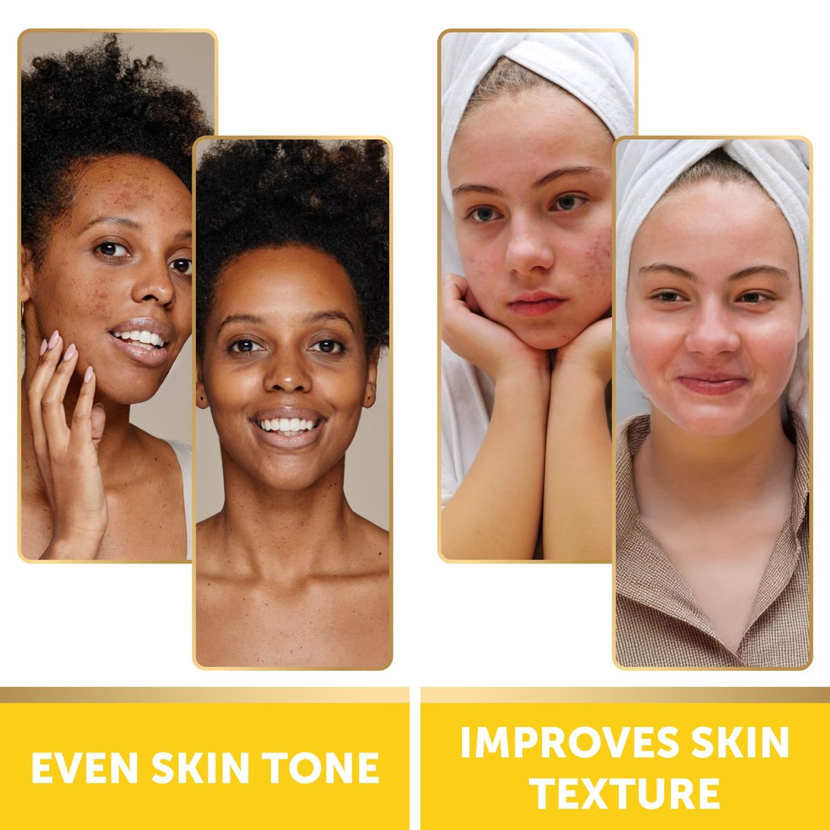 VALITIC Turmeric Kojic Acid Cleansing Pads - Exfoliating Dark Spot Remover for Face with Vitamin C, Alpha Arbutin, Niacinamide and Retinol - 60 Count Avelisse