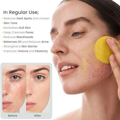 Kojic Acid Turmeric Exfoliating Cleansing Pads with Vitamin C – Dark Spot Remover & Deep Pore Cleanser, 50 Cotton Pads - görsel 16