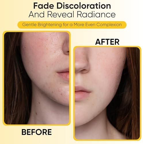 Kojic Acid Turmeric Exfoliating Cleansing Pads with Vitamin C – Dark Spot Remover & Deep Pore Cleanser, 50 Cotton Pads - görsel 6