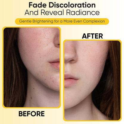 Kojic Acid Turmeric Exfoliating Cleansing Pads with Vitamin C – Dark Spot Remover & Deep Pore Cleanser, 50 Cotton Pads