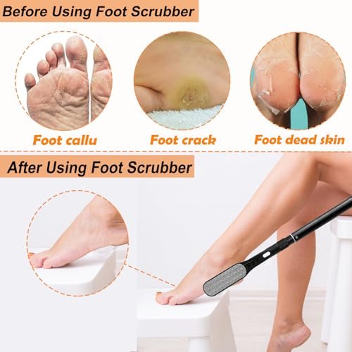 Gobiteli Telescopic Long Handle Foot Brush – 18.8"-25.9" Adjustable Toe Cleaning Brush & Foot File for Hard Skin Removal – Ideal for Seniors, Men, and Women Avelisse