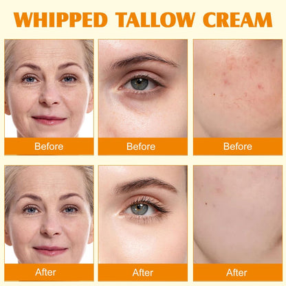 Meifenla Beef Tallow for Skin – Tallow and Honey Cream Natural Face Moisturizer, Hydrating Beef Tallow Balm for Face & Body Avelisse