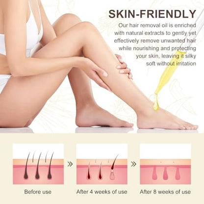Cyprus Rotundus Oil - Natural Hair Removal Solution, Reduces Body Hair Growth, Smooths & Moisturizes Skin, Suitable for All Skin Types, 2.03 oz