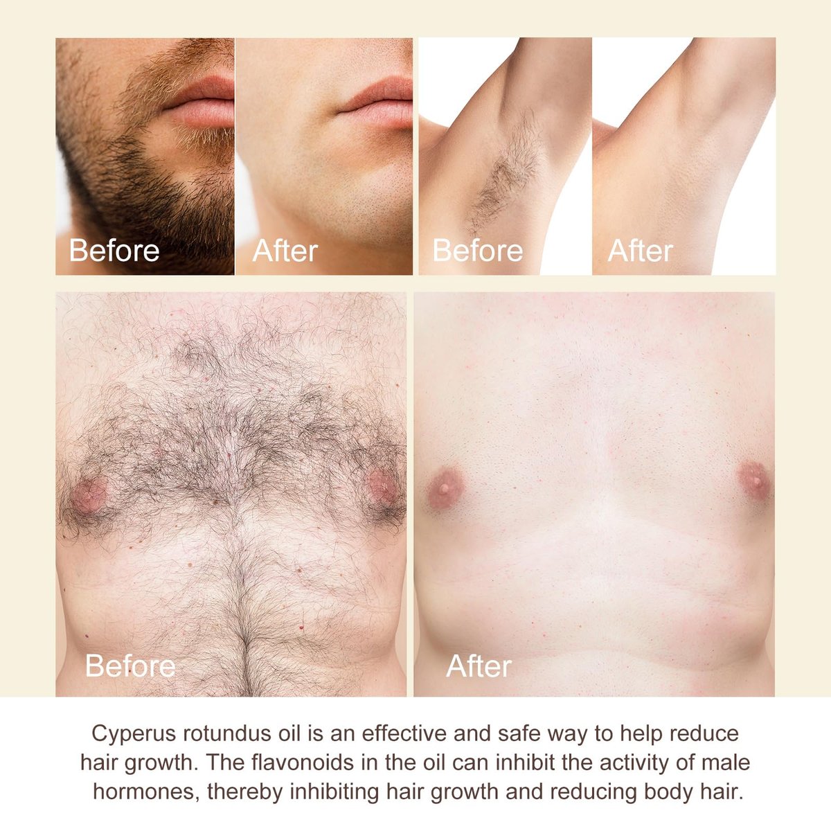 Cyprus Rotundus Oil - Natural Hair Removal Solution, Reduces Body Hair Growth, Smooths & Moisturizes Skin, Suitable for All Skin Types, 2.03 oz - görsel 11