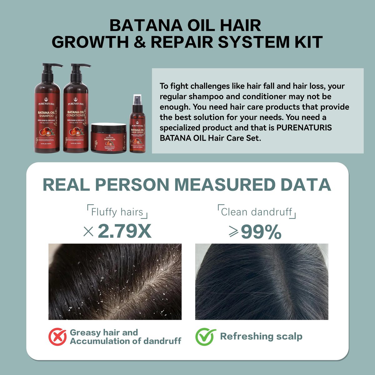 100% Natural Raw Organic Batana Oil Complete Hair Growth & Repair System Kit – Sulfate-Free Shampoo, Conditioner, Hair Mask & Leave-In Spray for Thickness & Anti-Hair Loss for Men Women Avelisse