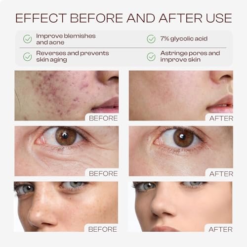 Glycolic Acid Toner 7% | Exfoliating Toning Solution 240ml – SADOWAY - görsel 6