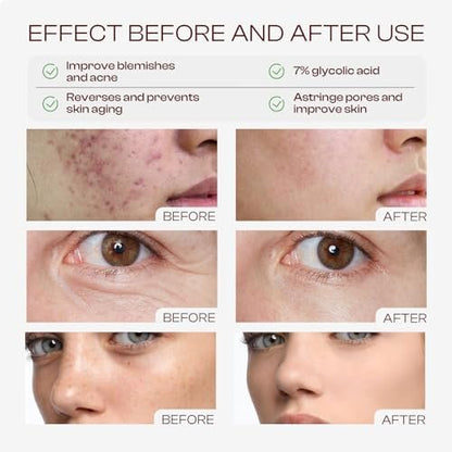 Glycolic Acid Toner 7% | Exfoliating Toning Solution 240ml – SADOWAY