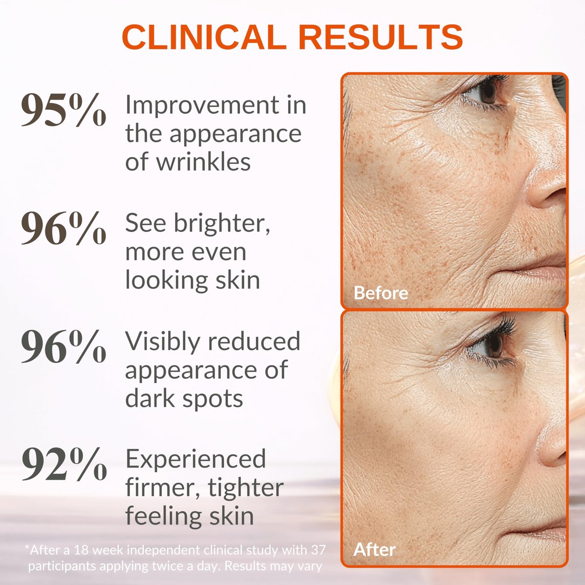LeVaye Vitamin C Serum – Anti-Aging Face Serum with 15% Vitamin C, Ferulic Acid, Niacinamide, Hyaluronic Acid, Peptides, Ceramides – Targets Wrinkles, Fine Lines, Dark Spots, Enlarged Pores, Dry Skin Avelisse
