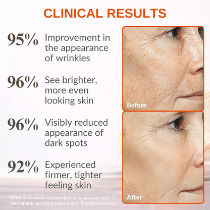 LeVaye Vitamin C Serum – Anti-Aging Face Serum with 15% Vitamin C, Ferulic Acid, Niacinamide, Hyaluronic Acid, Peptides, Ceramides – Targets Wrinkles, Fine Lines, Dark Spots, Enlarged Pores, Dry Skin Avelisse
