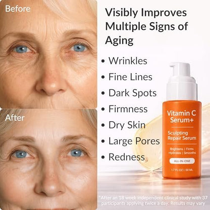 LeVaye Vitamin C Serum – Anti-Aging Face Serum with 15% Vitamin C, Ferulic Acid, Niacinamide, Hyaluronic Acid, Peptides, Ceramides – Targets Wrinkles, Fine Lines, Dark Spots, Enlarged Pores, Dry Skin Avelisse