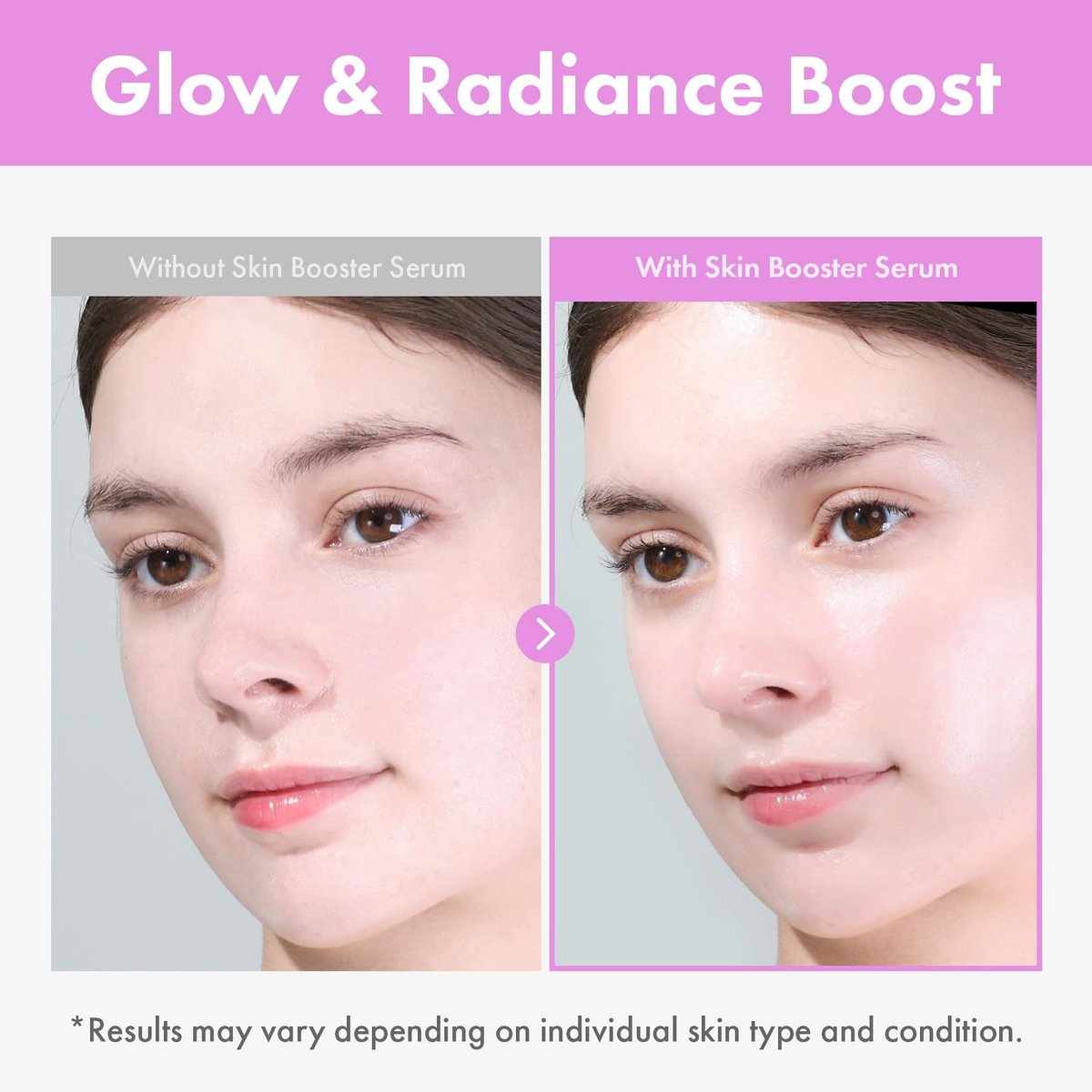 TOSOWOONG 9 Peptide Skin Booster Serum with Niacinamide & Hyaluronic Acid – Korean Skin Care Face Essence for All Skin Types, Paraben Free, 150ml (5.07 fl.oz) Avelisse