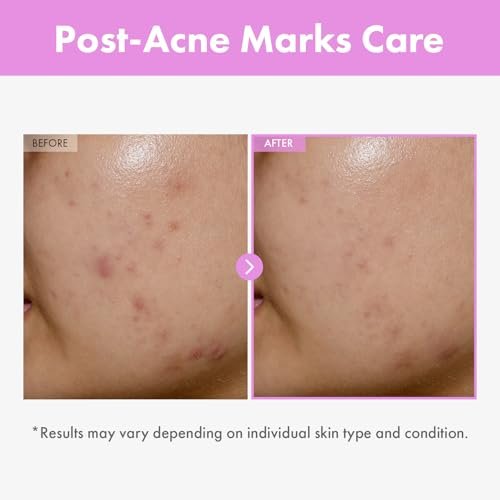TOSOWOONG 9 Peptide Skin Booster Serum with Niacinamide & Hyaluronic Acid – Korean Skin Care Face Essence for All Skin Types, Paraben Free, 150ml (5.07 fl.oz) Avelisse