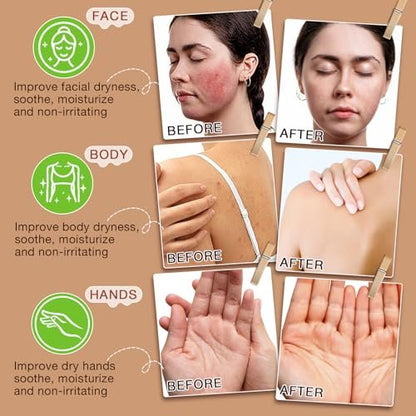 GOGIFTGO Beef Tallow for Skin - Tallow and Honey Balm Natural Face Moisturizer (4.2 Fl Oz) Avelisse