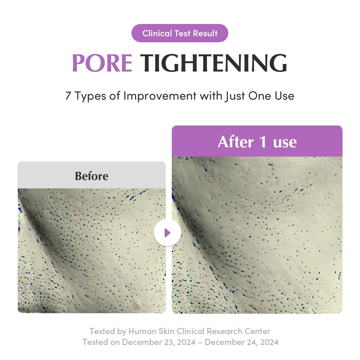 EQQUALBERRY Purple Rice Pore Purifying Pack Cleanser - Dual-Use Clay Mask & Foam Cleanser | Deep Cleansing for Pore Care & Skin Prep | AHA+BHA+PHA | Korean Skincare for Glass Skin, 4.58 OZ. (130g) - görsel 7