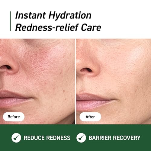 IVOSKIN Cica Redness Relief Treatment Cream – Soothing & Hydrating Green Correcting Moisturizer with Madecassoside, Helps Repair Skin Barrier for Sensitive Skin, Vegan Korean Skincare (1.76oz / 50g) - görsel 3