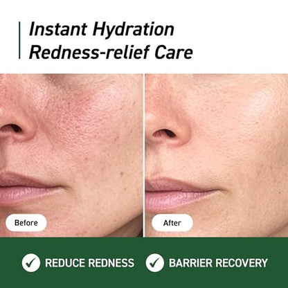 IVOSKIN Cica Redness Relief Treatment Cream – Soothing & Hydrating Green Correcting Moisturizer with Madecassoside, Helps Repair Skin Barrier for Sensitive Skin, Vegan Korean Skincare (1.76oz / 50g)