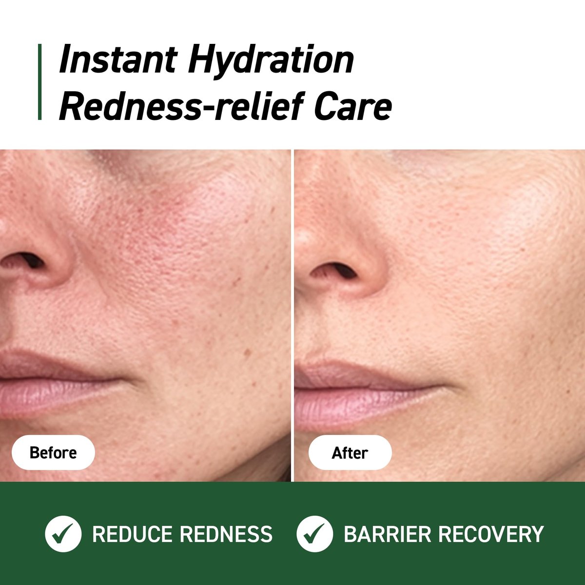 IVOSKIN Cica Redness Relief Treatment Cream – Soothing & Hydrating Green Correcting Moisturizer with Madecassoside, Helps Repair Skin Barrier for Sensitive Skin, Vegan Korean Skincare (1.76oz / 50g) - görsel 4