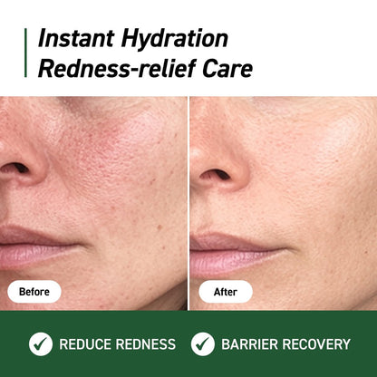 IVOSKIN Cica Redness Relief Treatment Cream – Soothing & Hydrating Green Correcting Moisturizer with Madecassoside, Helps Repair Skin Barrier for Sensitive Skin, Vegan Korean Skincare (1.76oz / 50g)