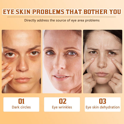 Lumibalm Turmeric Eye Stick for Under Eye Bags – Erases Puffiness in Minutes with Retinol & Turmeric (2-Pack) Avelisse