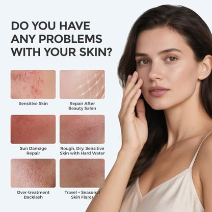 SKINERSE Intensive Repair Serum with 15% Hyaluronic Acid, Ceramides & Centella – 30 Vials Daily Travel Care for Sensitive Skin, Anti-Aging, Calming Barrier Repair & Redness Relief Avelisse