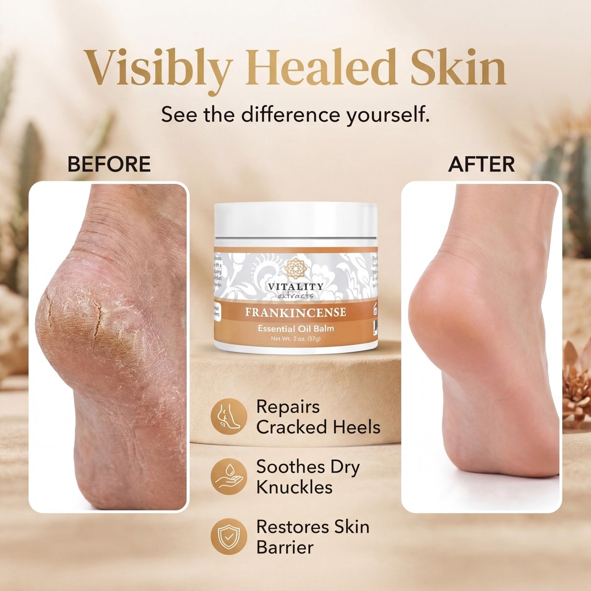 Vitality Extracts Frankincense Essential Oil Balm (2oz) – Deep Moisturizing Skin Balm for Dry, Cracked Skin with Boswellia Serrata, Beeswax & Vitamin E, Soothing & Nourishing for All Skin Types Avelisse