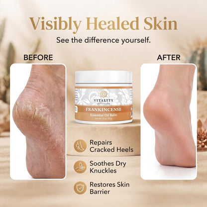 Vitality Extracts Frankincense Essential Oil Balm (2oz) – Deep Moisturizing Skin Balm for Dry, Cracked Skin with Boswellia Serrata, Beeswax & Vitamin E, Soothing & Nourishing for All Skin Types Avelisse