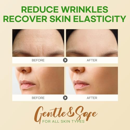 SILKDERMIS Smile Line and Forehead Wrinkle Patches – 24 Smile Line + 12 Forehead Patches with Aloe, Collagen & Vitamin E Avelisse