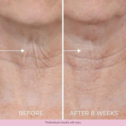 DEKLIDERM Neck Firming Cream – Anti Aging Retinol Cream for Neck Wrinkles and Sagging – Restore Firmness with Retinol & Moisturizers Avelisse