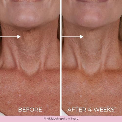 DEKLIDERM Neck Firming Cream – Anti Aging Retinol Cream for Neck Wrinkles and Sagging – Restore Firmness with Retinol & Moisturizers Avelisse