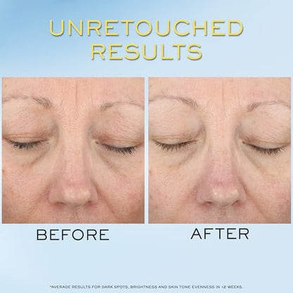 Lancôme Supra Screen Invisible Serum Sunscreen SPF 50+ - Anti-Aging Correction & Protection - All Skin Types - 48 HR Hydration, Radiant Finish Avelisse