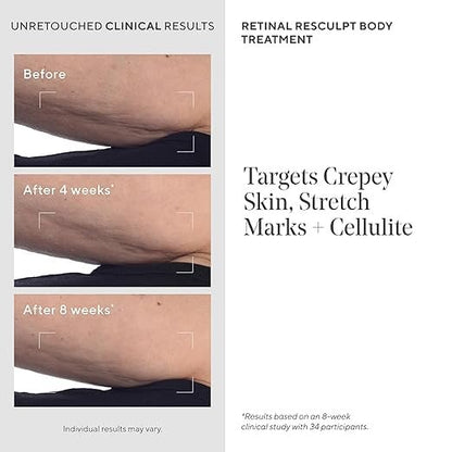 Murad Retinal ReSculpt Body Treatment – Encapsulated Retinal, Shea & Avocado Extract Body Cream to Firm, Lift, and Smooth Crepey Sagging Skin, Targeting Cellulite and Stretch Marks Nightly – 5.0 Fl Oz Avelisse
