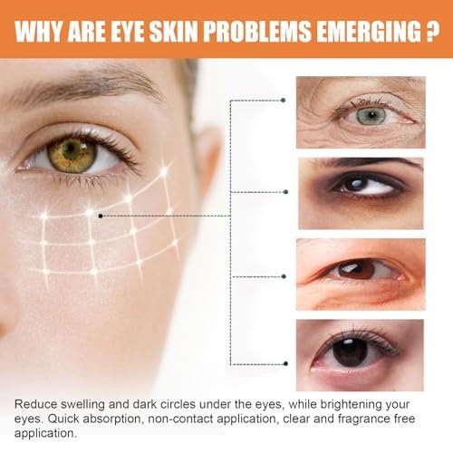 LOYOTICE Revive Glow Vitamin C Eye Balm – 3-Pack Hydrating Eye Cream Stick for Brightening, Dark Circles & Puffiness Avelisse