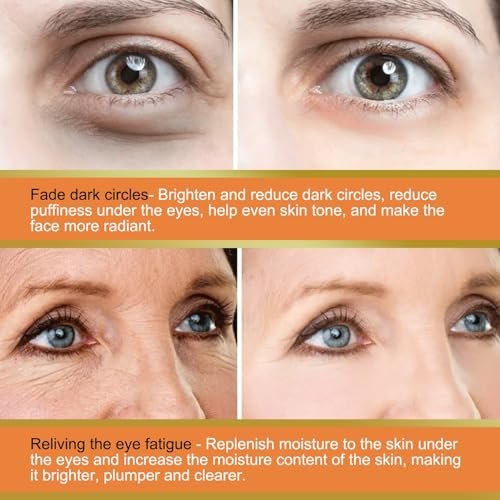 LOYOTICE Revive Glow Vitamin C Eye Balm – 3-Pack Hydrating Eye Cream Stick for Brightening, Dark Circles & Puffiness Avelisse