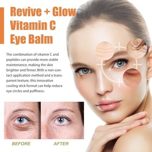 LOYOTICE Revive Glow Vitamin C Eye Balm – 3-Pack Hydrating Eye Cream Stick for Brightening, Dark Circles & Puffiness Avelisse
