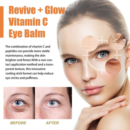 LOYOTICE Revive Glow Vitamin C Eye Balm – 3-Pack Hydrating Eye Cream Stick for Brightening, Dark Circles & Puffiness Avelisse