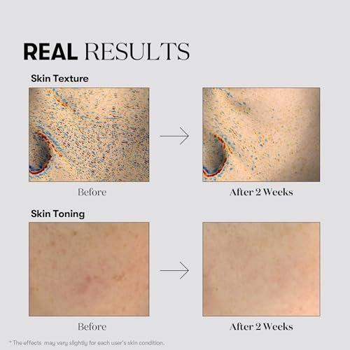 VT COSMETICS TX Toning Essence 1000 Shot - Tranexamic Acid Serum with Niacinamide & Glutathione for Radiant Glass Skin, Dark Spots, Sun Spots, Age Spots, Acne Scars - Korean Skin Care (1.01 fl. oz.) Avelisse