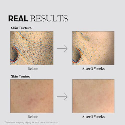 VT COSMETICS TX Toning Essence 1000 Shot - Tranexamic Acid Serum with Niacinamide & Glutathione for Radiant Glass Skin, Dark Spots, Sun Spots, Age Spots, Acne Scars - Korean Skin Care (1.01 fl. oz.) Avelisse