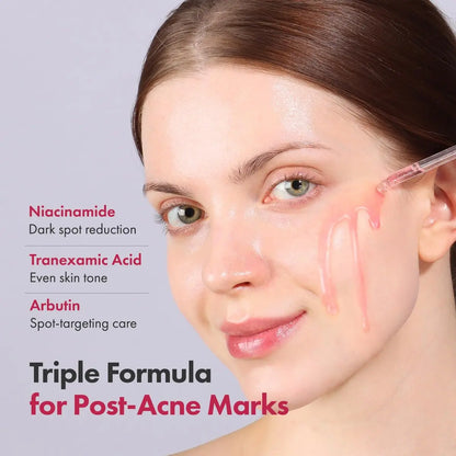 TOSOWOONG Niacinamide 10% + Tranexamic Acid 4% Serum – Brightening & Clarifying Facial Serum with Arbutin, Hyaluronic Acid, Glass Skin Effect, Korean Skincare, 1.11 fl oz Avelisse
