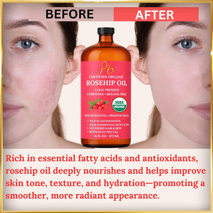USDA Organic Rosehip Oil – 100% Pure, Cold-Pressed & Unrefined Face Oil for Skin & Hair – 16 fl oz Glass Bottle Avelisse