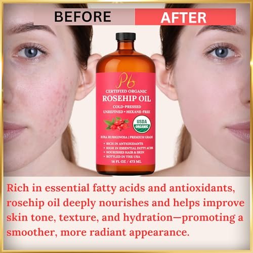 USDA Organic Rosehip Oil – 100% Pure, Cold-Pressed & Unrefined Face Oil for Skin & Hair – 16 fl oz Glass Bottle Avelisse