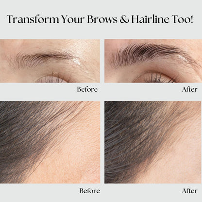 KAEMEX Eyelash Growth Serum & Conditioner Set - Hormone Free for Sensitive Eyes - 3ml Lash Serum + 3ml Eyelash Conditioner